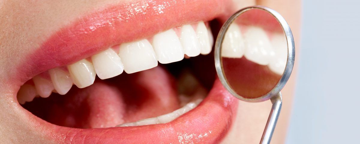 Blanqueamiento dental en Santander y Solares