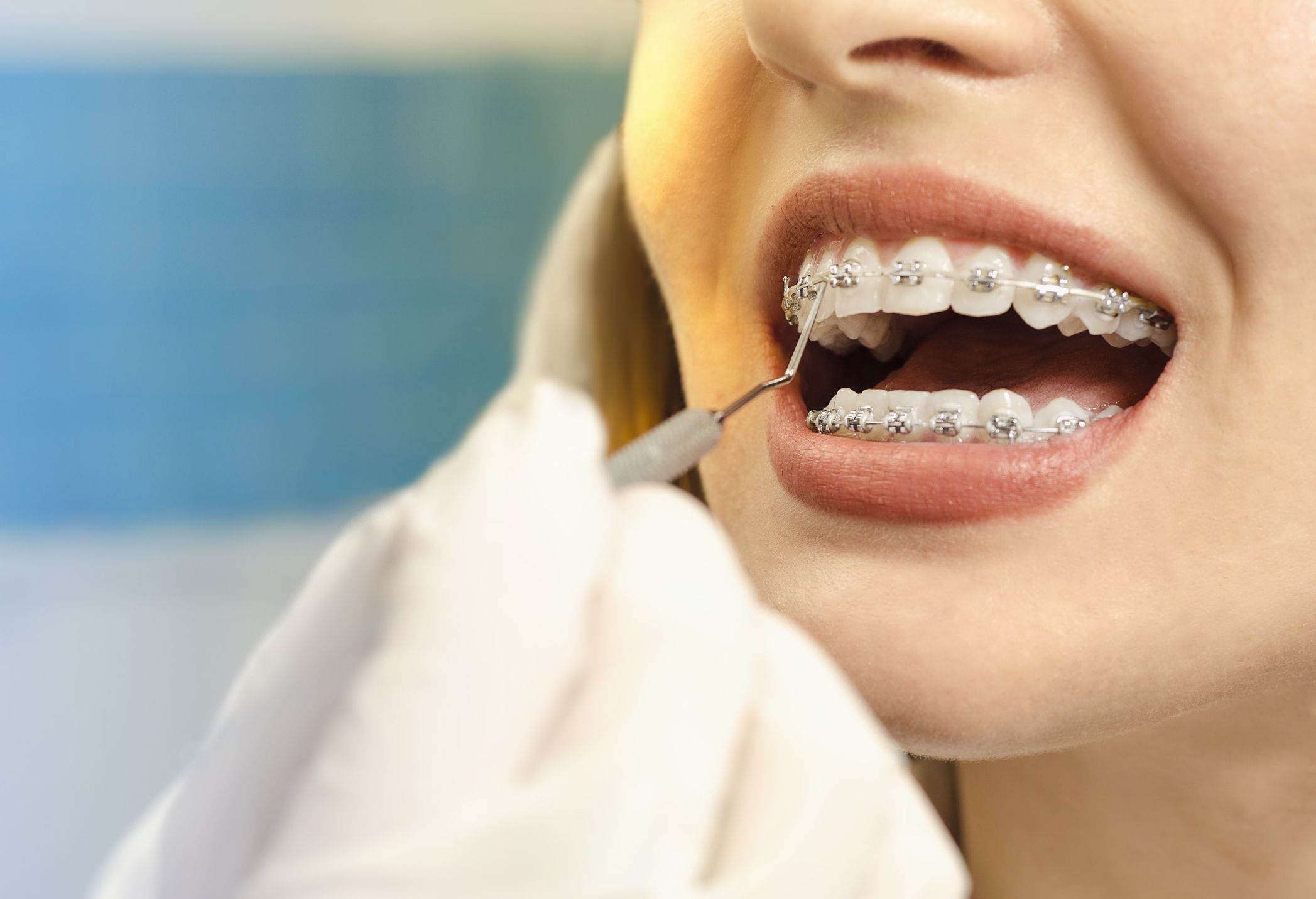 cuidar dientes con brackets