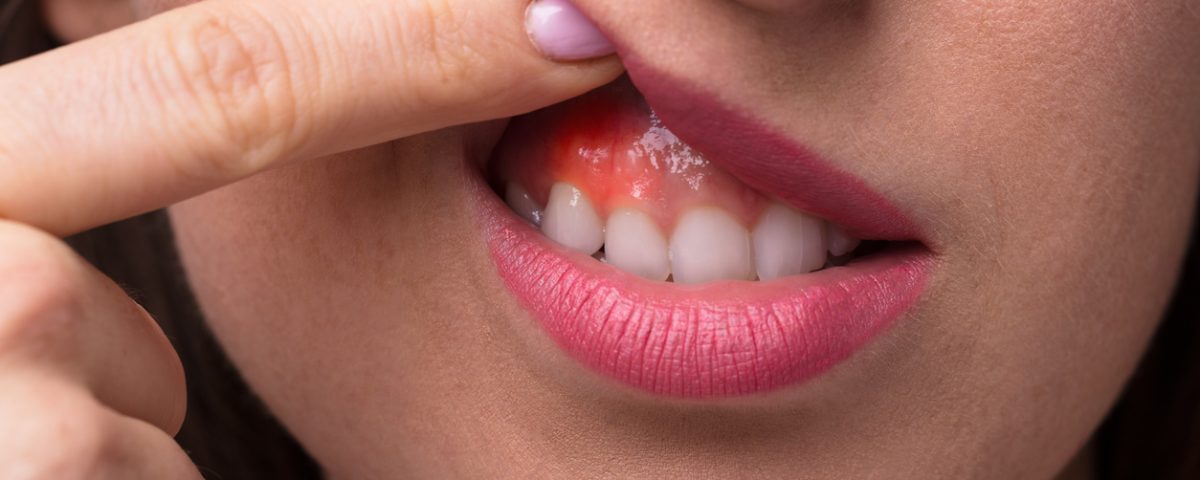 enfermedades periodontales