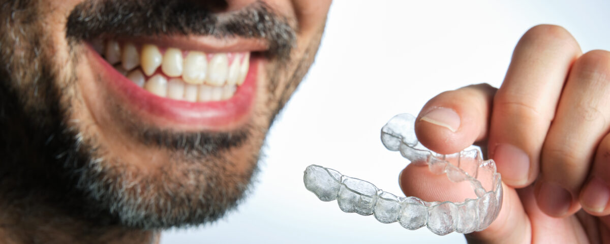 retenedores tras la ortodoncia