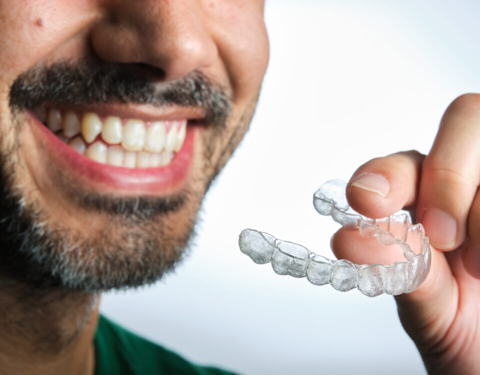 retenedores tras la ortodoncia