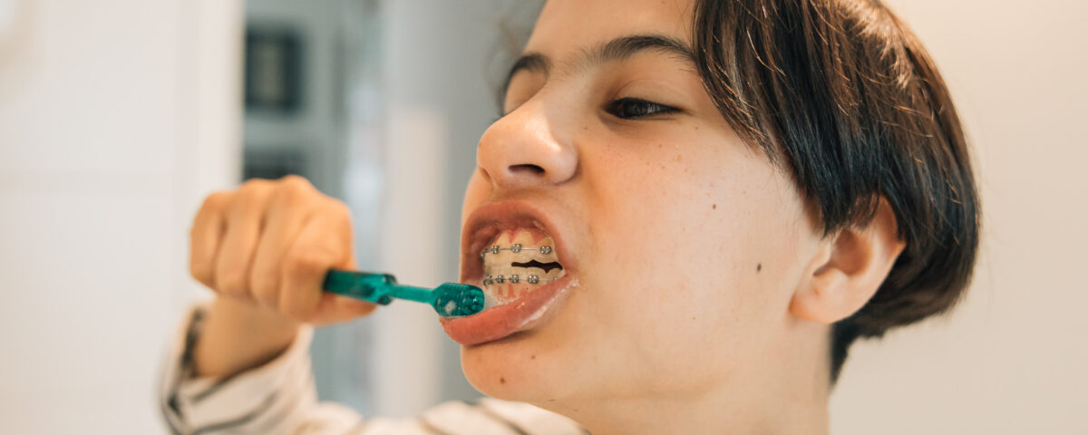 higiene oral brackets