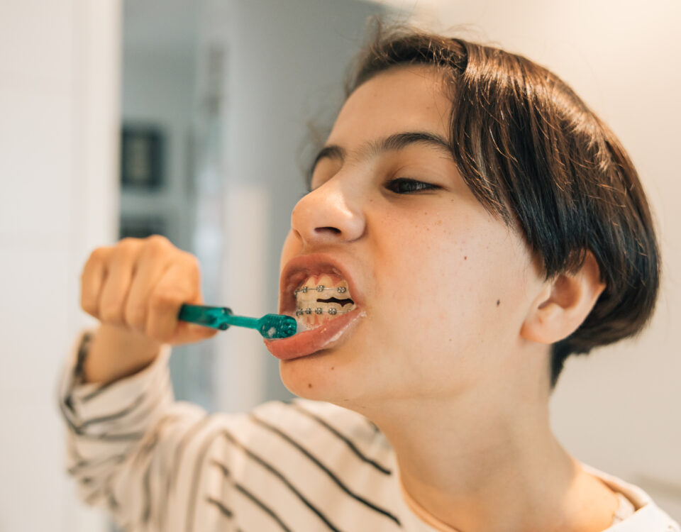 higiene oral brackets