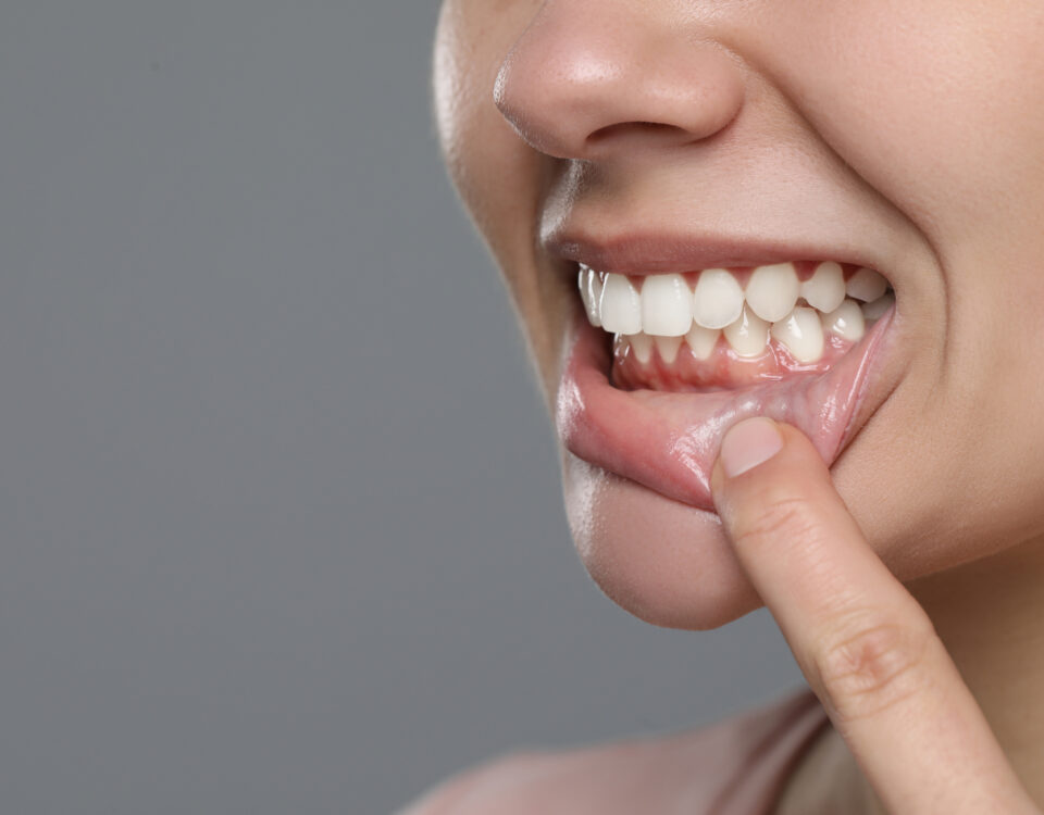 Enfermedades periodontales