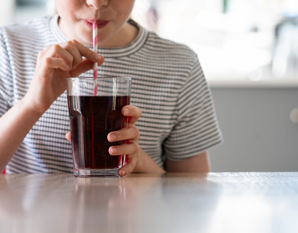 alimentos que manchan los dientes