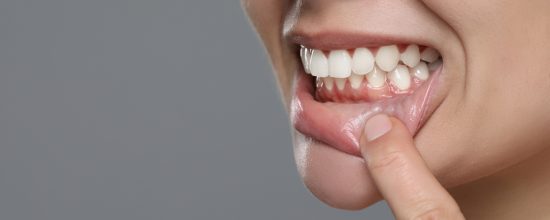 Enfermedades periodontales