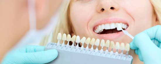 Blanqueamiento dental