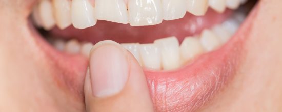 curiosidades de los dientes